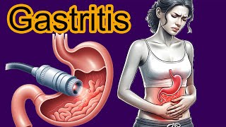 5 Early signs of Gastritis Gastritis diagnosis and treatment [upl. by Witty752]