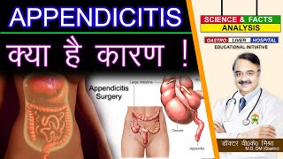 APPENDICITIS क्या है कारण   WHAT CAUSES APPENDICITIS [upl. by Baker]