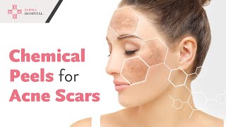 Chemical Peel Benefits and Treatment  Stay Healthy with CK Birla Hospital [upl. by Bornie]