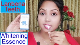 How to Use Lanbena teeth Whitening Essence । lanbena Teeth Whitening Essence Review । Honest Review [upl. by Aerdnac]