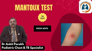 Mantoux Test or Tuberculin Skin Test I DR Ankit Parakh Child Chest amp TB Specialist [upl. by Brookhouse]