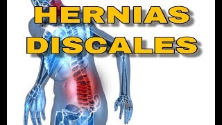 COMO MEJORAR SIN CIRUGIA  hernias discales sintomas recuperacion estiramientos hernia discal [upl. by Rraval]