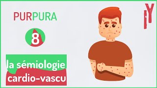 EPISODE7 sémiologie cardiovasculaire purpura [upl. by Airbmat]