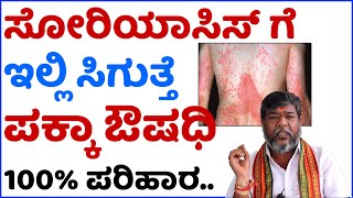 Psoriasis Ge Mane Maddu  Skin Disease  Hema Babu  Dr Guide In Kannada [upl. by Aviva]