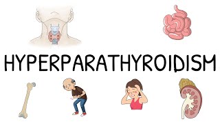 Hyperparathyroidism Primary Secondary and Tertiary  Simple and easy to understand [upl. by Yanat]