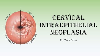 OampG Cervical intraepithelial neoplasia  for medical students [upl. by Nyrac]