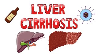 Liver Cirrhosis  What happens in Liver Cirrhosis  Pathophysiology Causes Signs amp Symptoms [upl. by Magena]