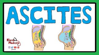 ASCITES  Serum Ascites Albumin Gradient SAAG  Ascites Pathophysiology  Ascites Causes [upl. by Amyas]