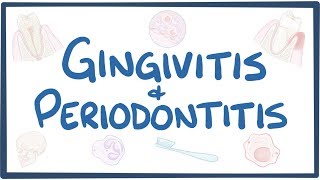 Gingivitis and periodontitis  causes symptoms diagnosis treatment pathology [upl. by Halvaard434]