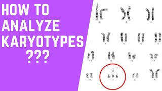 How to Analyze Karyotypes 101 [upl. by Ettennod194]