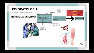 TROMBOSIS VENOSA PROFUNDA Y EMBOLISMO PULMONAR TEPTVP [upl. by Ivanah58]