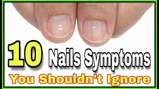 10 Nail Symptoms and What They Mean for Your Health You Shouldnt Ignore [upl. by Tine95]