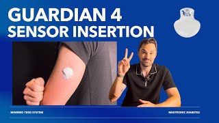 Medtronic Guardian 4 sensor insertion  How to Insert The Guardian 4 sensor [upl. by Mariandi]