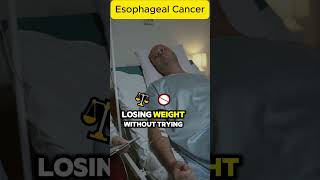 Esophageal Cancer Symptoms Risk Factors and Treatment Options [upl. by Chaudoin789]