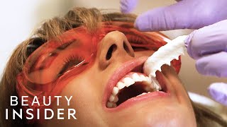 The Fastest Way Dentists Whiten Teeth  Beauty Explorers  Beauty Insider [upl. by Tobi]