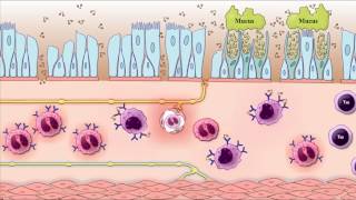 Asthma Pathogenesis Animation Part 2reexposure to allergen Robbins pathology [upl. by Bigford]