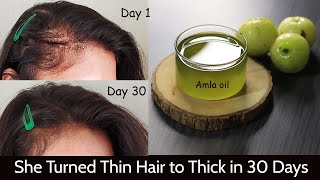 My Mom Turned her Thin Hair to Thick Hair in 30 Days  Amla Hair Oil for Hair Growth amp Long Hair [upl. by Haleelahk]