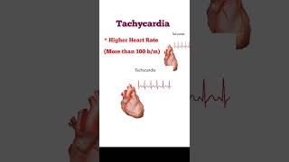 Tachycardia increase heart rate short vedeo [upl. by Kam]