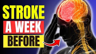 10 Warning Signs of Stroke A Week Before It Happens  Healthiera [upl. by Igor96]