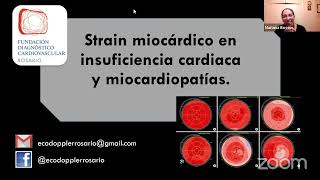 10 Ateneo FDCVR  Strain Miocárdico en IC y miocardiopatías  Dr Diego Freytes [upl. by Assirahs]