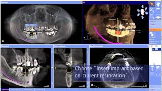 CEREC meet Galileos details en werkwijze bij Henry Schein Nederland [upl. by Polak]