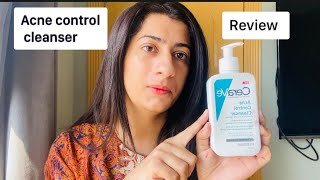 CeraVe Acne Control Cleanser Review [upl. by Atiruam]