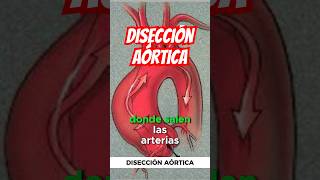 Disección aórtica 🫀 emergency doctor [upl. by Nedap260]