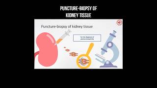 Puncture  biopsy of kidney tissue puncture kidneyhealth kidneydisease biopsy [upl. by Arihppas]