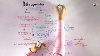 Osteoporosis in Urdu\Hindi  Biomechanics of human bone growth and development [upl. by Standing395]