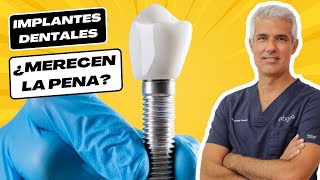 ✅ Implantes Dentales ¿Merecen la pena  Ventajas y Desventajas [upl. by Einhpad908]