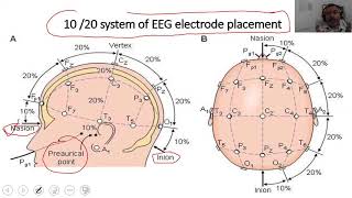 How to place electrodes for EEG 10 20 system of Electrode Placement  EEG electrode placement map [upl. by Tivad]