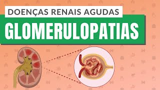 DOENÇAS RENAIS AGUDAS  PARTE 1 Glomerulopatias [upl. by Foss]