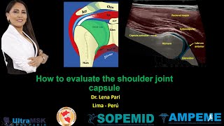 ¿Como evaluar la cápsula articular del hombro Dra Lena Pari [upl. by Wendie]