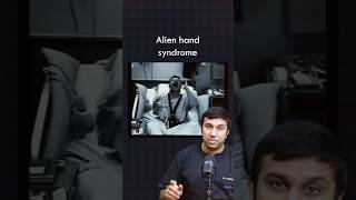 What is an Alien Hand Syndrome [upl. by Ydnab]