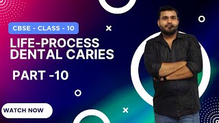 Life Processes Class 10 Science Biology  Lecture10  CBSE Board  Devendra Sir [upl. by Asiak]