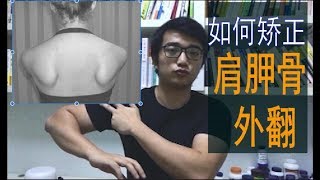 矫正肩胛骨外翻 Fix scapular winging 防止虎背熊腰 [upl. by Sundstrom]