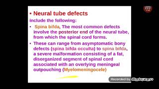 CNS Malformations [upl. by Enineg]