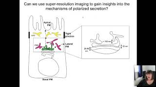 Aurox Conference on Microscopy Day 1 Session 3 SuperResolution [upl. by Goodard]