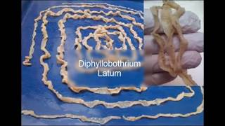 Diphyllobothrium latum [upl. by Yrotciv714]