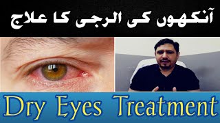 Eye Allergy Treatment urduhindi  Dry eyes Treatment  Eye Allergy Drops  Allergic conjunctivitis [upl. by Malanie]