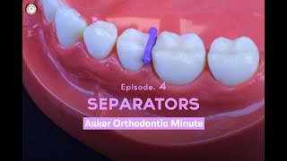 Separators Asker Orthodontic Minute Episode 4 [upl. by Rockie]