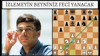 İzlemeyin Beyniniz Feci Yanacak [upl. by Arotak775]