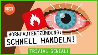 So entsteht eine Hornhautentzündung im Auge  trivialgenial  DAKGesundheit [upl. by Novad732]