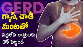 GERD Symptoms amp Treatment  Acidity Solution in Telugu [upl. by Reilamag148]