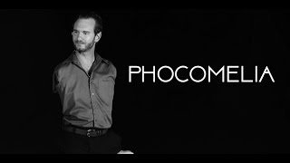 Nick Vujicic  Phocomelia  Attitude Is Altitude [upl. by Temme756]