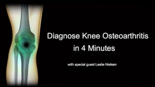 Diagnose Knee Osteoarthritis in 4 Minutes with Leslie Nielsen [upl. by Wheeler348]