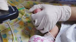 How to check RBS in newborn babyHeel prick for glucose test in babybabynicu newbornhospital [upl. by Amadeus]