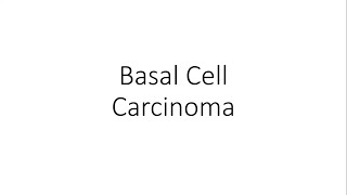 Basal Cell Carcinoma  For Medical Students [upl. by Youngman]