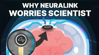 How Neuralink’s Breakthrough Worries Scientists [upl. by Conlen]