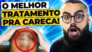 QUAL MELHOR TRATAMENTO PARA QUEDA DE CABELO MASCULINO [upl. by Thetes]